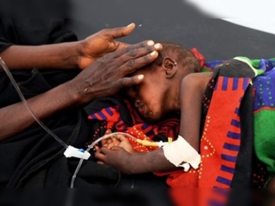 Somali hastanelerinde aşçı var, aş yok