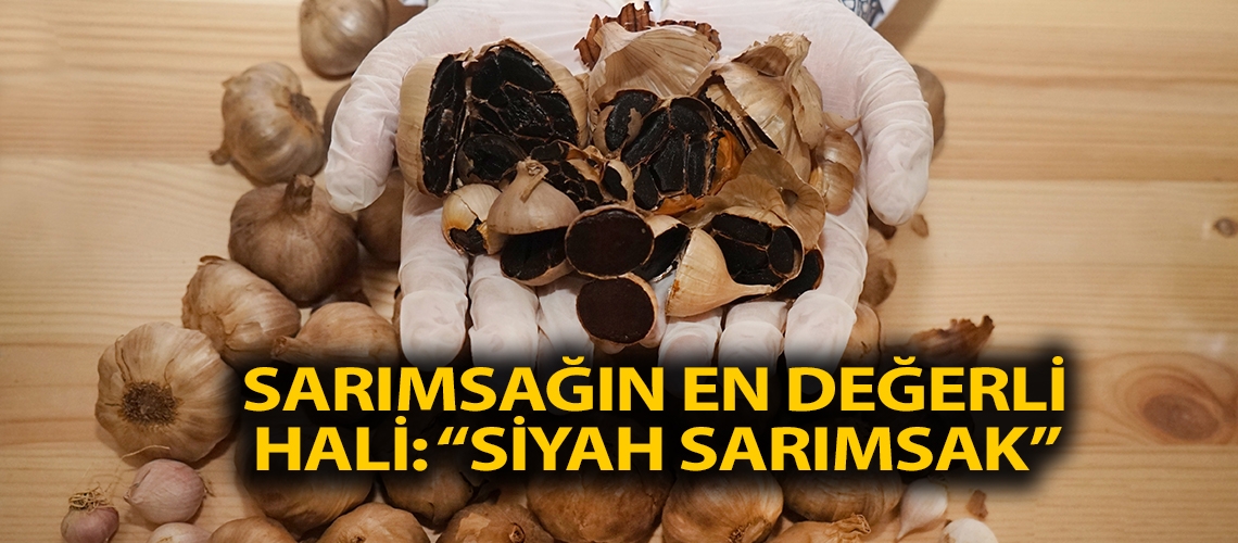 Sarımsağın en değerli hali: “siyah sarımsak”