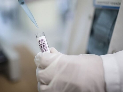 Kütahya’da şap hastalığı uyarısı